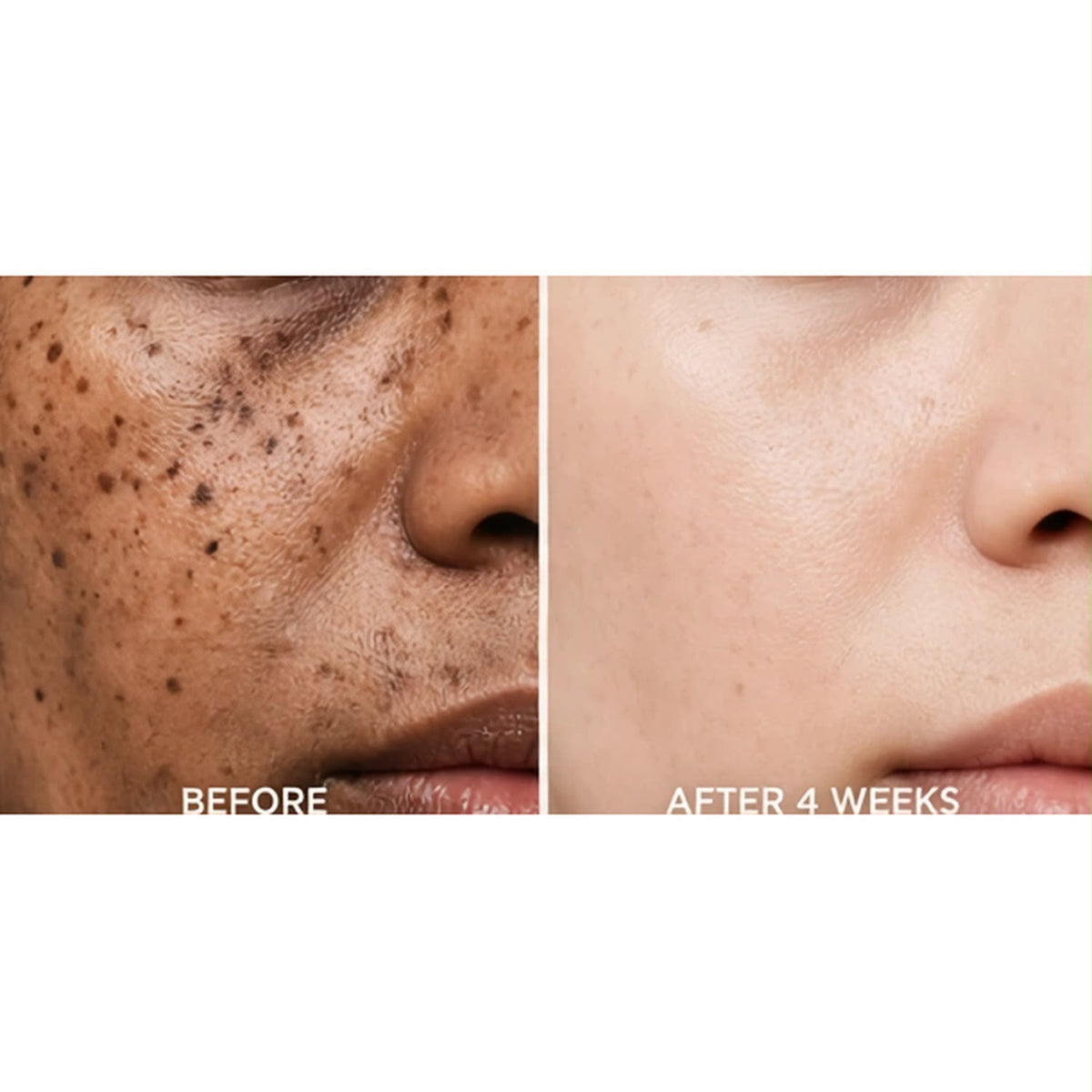 Anua Niacinamide 10+ TXA 4